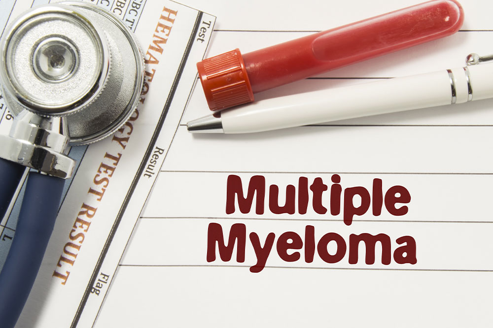 6 early signs of multiple myeloma